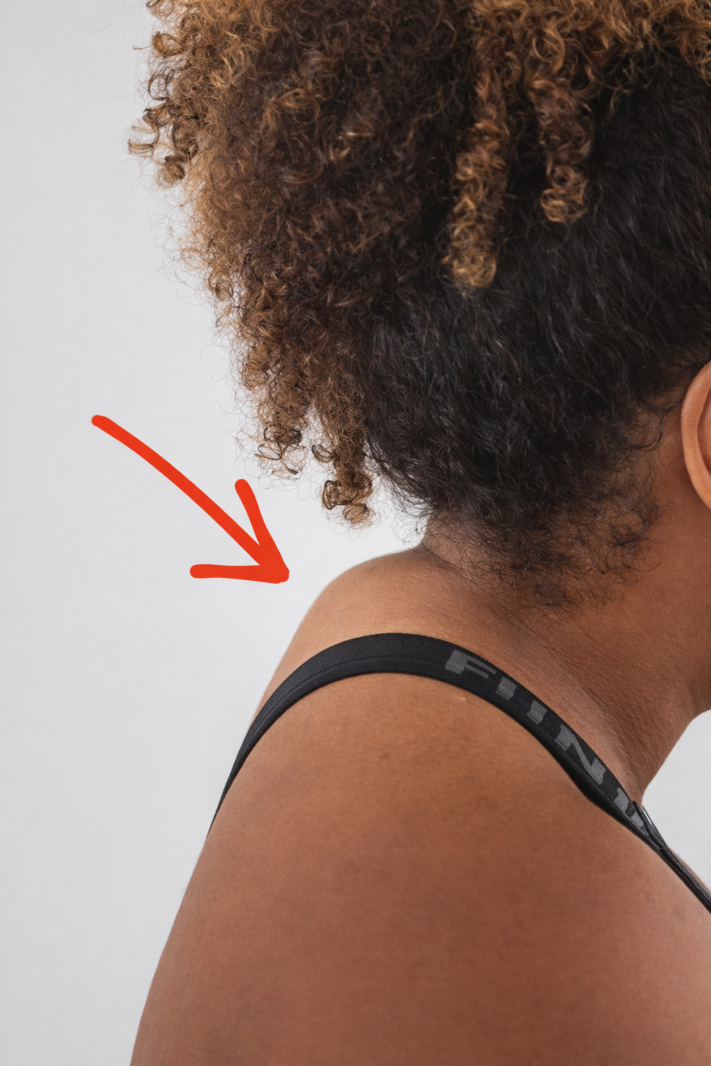 Calombo no pescoço — corcunda de bisão