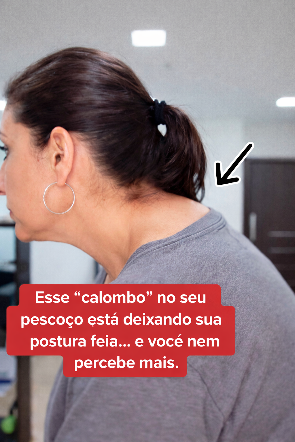 Antes e depois — calombo no pescoço eliminado